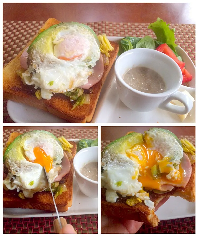 chinese cabbage,ham w/OM's Fried egg in avocado🍳open sandwich🍳とろｼｬｷ白菜とﾊﾑのｱﾎﾞｶﾄﾞ目玉焼き乗せｵｰﾌﾟﾝｻﾝﾄﾞ|🌈Ami🍻さん