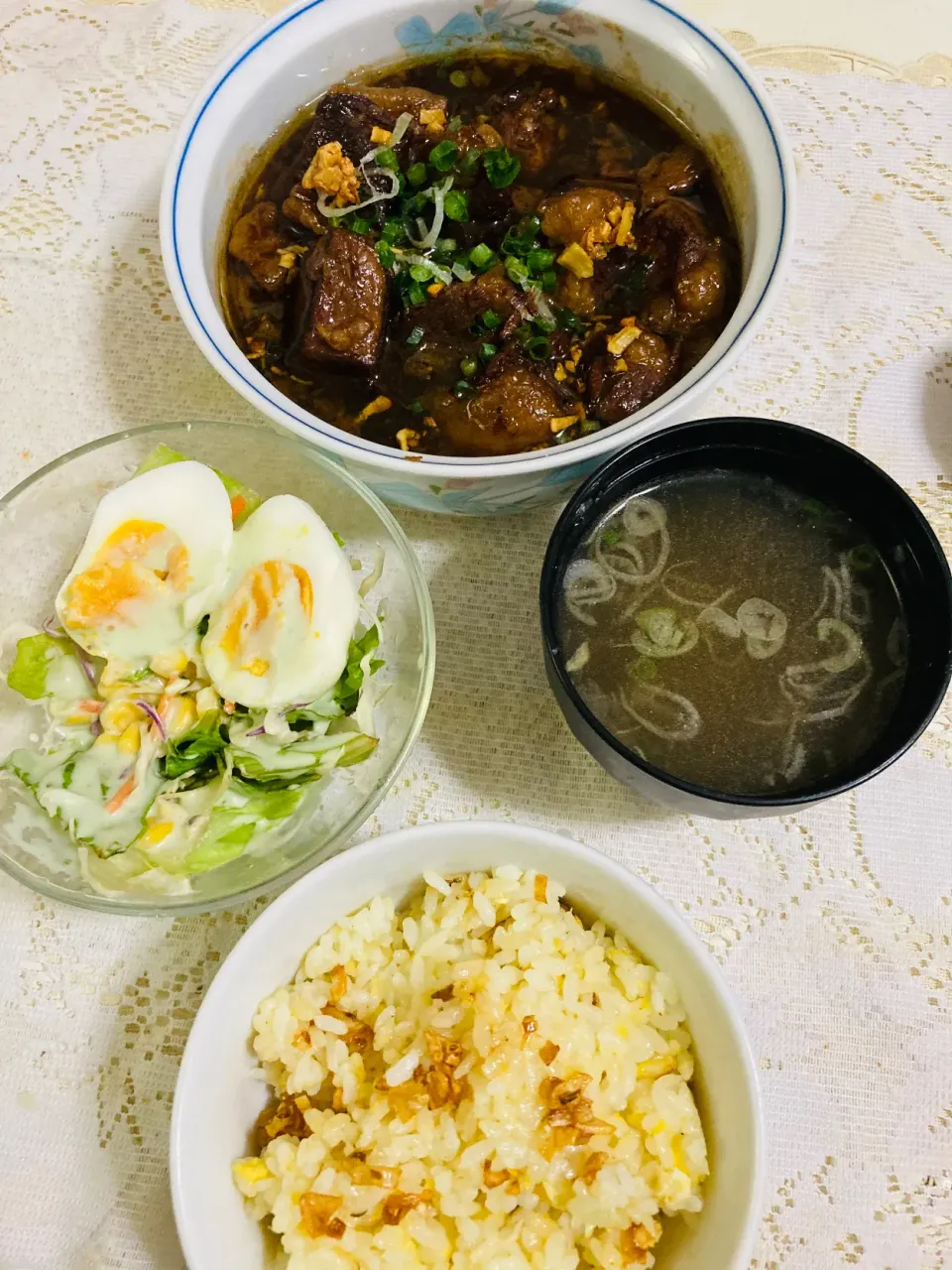 Beef Pares#Garlic Fried Rice#Beef Broth Soup#Mix Vegetable Salad ビーフパレ、ガーリックチャーハン、ビーフブロススープ、ミックス野菜サラダ|MJ🇵🇭🇯🇵さん